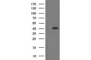 HEK293T cells were transfected with the pCMV6-ENTRY control (Left lane) or pCMV6-ENTRY RLBP1 (Right lane) cDNA for 48 hrs and lysed. (RLBP1 抗体)