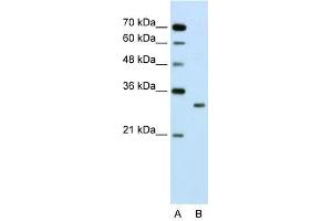 SBDS antibody used at 2. (SBDS 抗体  (N-Term))