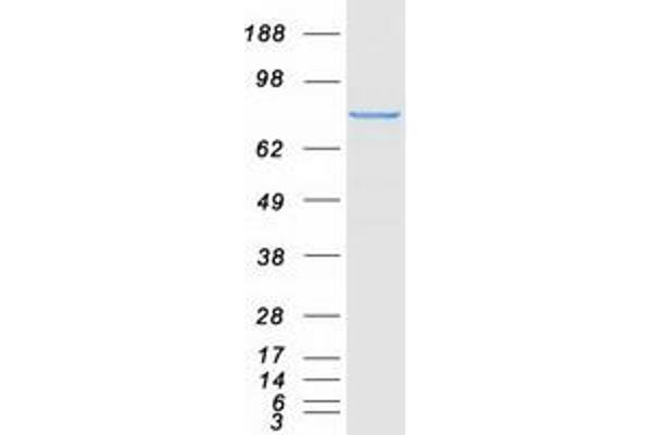 JUP Protein (Transcript Variant 1) (Myc-DYKDDDDK Tag)