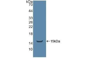 Detection of Recombinant ADRbK1, Human using Polyclonal Antibody to TEK Tyrosine Kinase, Endothelial (Tie2) (TEK 抗体  (AA 1-116))