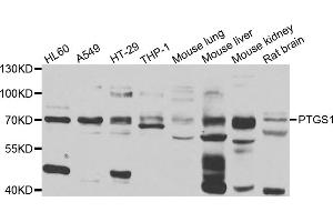 Western blot analysis of extracts of various cell lines, using PTGS1 antibody (ABIN4904895) at 1:1000 dilution. (PTGS1 抗体)