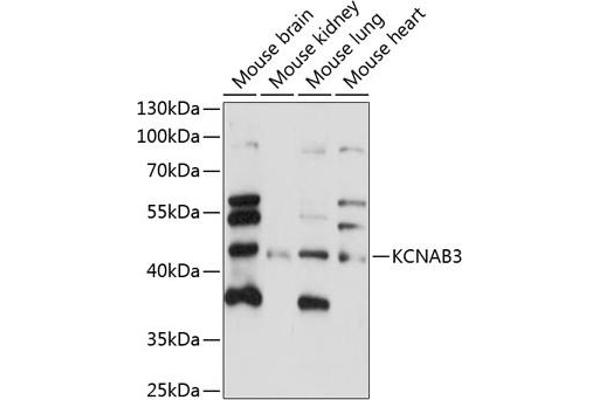 KCNAB3 抗体  (AA 285-404)