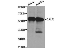 Western Blotting (WB) image for anti-Calreticulin (CALR) antibody (ABIN6214923) (Calreticulin 抗体)