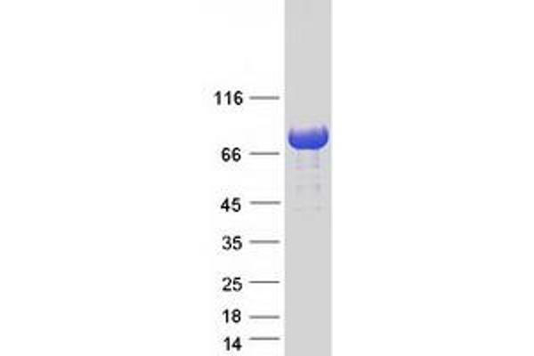 TBC1D25 Protein (Myc-DYKDDDDK Tag)