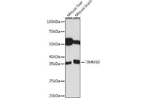 Western blot analysis of extracts of various cell lines, using TIMM50 Rabbit mAb (ABIN1513120, ABIN3022092, ABIN3022093 and ABIN7101443) at 1:1000 dilution. (TIMM50 抗体)