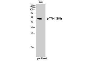 Western Blotting (WB) image for anti-Tryptophan Hydroxylase 1 (TPH1) (pSer58) antibody (ABIN3173282) (Tryptophan Hydroxylase 1 抗体  (pSer58))
