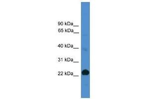 CD8A antibody used at 0. (CD8 alpha 抗体  (Middle Region))