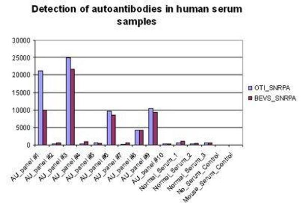 SNRPA1 Protein (Myc-DYKDDDDK Tag)