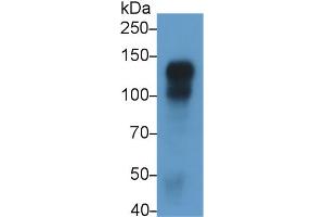 Detection of CDH5 in Rat Placenta lysate using Monoclonal Antibody to Cadherin 5 (CDH5) (Cadherin 5 抗体  (AA 59-382))