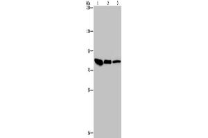 Western Blotting (WB) image for anti-Junction Plakoglobin (JUP) antibody (ABIN2423687) (JUP 抗体)
