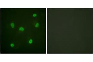 Immunofluorescence analysis of HeLa cells, using Histone H2B (Ab-5) Antibody. (Histone H2B 抗体  (AA 1-50))