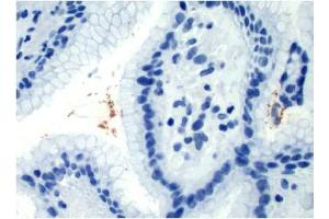 Image no. 1 for anti-Helicobacter Pylori (H. pylori) antibody (ABIN952704) (Helicobacter Pylori 抗体)