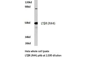 Western blot (WB) analysis of LTβR antibody in extracts from HeLa cells. (LTBR 抗体)