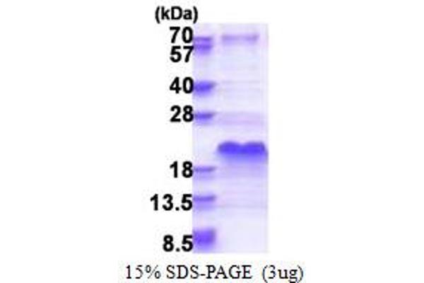 SHFM1 Protein (AA 1-70) (His tag)