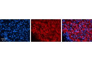 Rabbit Anti-EIF4G2 Antibody   Formalin Fixed Paraffin Embedded Tissue: Human Liver Tissue Observed Staining: Cytoplasm in hepatocytes Primary Antibody Concentration: 1:100 Other Working Concentrations: N/A Secondary Antibody: Donkey anti-Rabbit-Cy3 Secondary Antibody Concentration: 1:200 Magnification: 20X Exposure Time: 0. (EIF4G2 抗体  (N-Term))