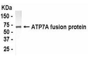 Western Blotting (WB) image for anti-ATPase, Cu++ Transporting, alpha Polypeptide (ATP7A) (AA 1407-1500) antibody (ABIN2467776) (ATP7A 抗体  (AA 1407-1500))
