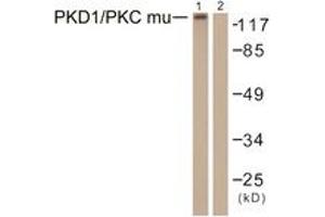 Western Blotting (WB) image for anti-Protein Kinase D1 (PRKD1) (AA 429-478) antibody (ABIN2888772) (PKC mu 抗体  (AA 429-478))