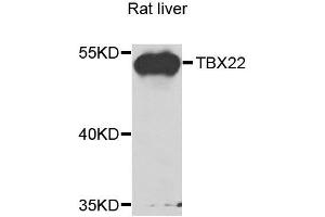 Western blot analysis of extracts of rat liver, using TBX22 antibody. (T-Box 22 抗体  (AA 291-520))