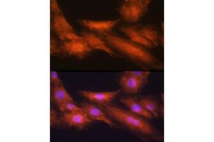 Immunofluorescence analysis of H9C2 cells using [KO Validated] HINT1 Rabbit pAb  at dilution of 1:100 (40x lens). (HINT1 抗体  (AA 1-126))