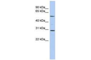 Image no. 1 for anti-V-Rel Reticuloendotheliosis Viral Oncogene Homolog B (RELB) (AA 395-444) antibody (ABIN6744395) (RELB 抗体  (AA 395-444))