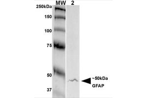 Western Blot analysis of Rat Brain Membrane showing detection of GFAP protein using Mouse Anti-GFAP Monoclonal Antibody, Clone S206A-8 . (GFAP 抗体  (AA 411-422) (PE))