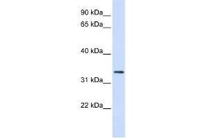 WB Suggested Anti-FBXO25 Antibody Titration:  0. (FBXO25 抗体  (N-Term))