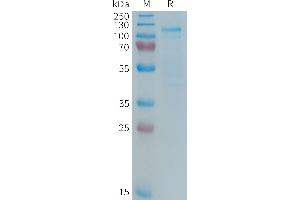 Human Protein, hFc Tag on SDS-PAGE under reducing condition. (LRP5 Protein (Fc Tag))