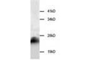 Image no. 1 for anti-Cystatin B (Stefin B) (CSTB) antibody (ABIN791546) (CSTB 抗体)