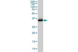 CDK6 monoclonal antibody (M01), clone 8H4 Western Blot analysis of CDK6 expression in Jurkat . (CDK6 抗体  (AA 3-99))