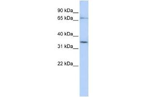 Western Blotting (WB) image for anti-Solute Carrier Organic Anion Transporter Family, Member 1C1 (SLCO1C1) antibody (ABIN2458796) (SLCO1C1 抗体)