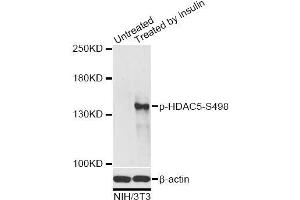 Western blot analysis of extracts of NIH/3T3 cells, using Phospho-HDAC5-S498 antibody (ABIN2987596) at 1/2000 dilution. (HDAC5 抗体  (pSer498))