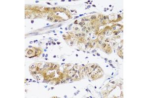 Immunohistochemistry of paraffin-embedded human stomach using NPPA antibody. (NPPA 抗体)