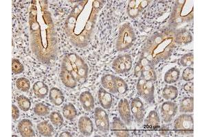 Immunoperoxidase of purified MaxPab antibody to KLK2 on formalin-fixed paraffin-embedded human small Intestine. (Kallikrein 2 抗体  (AA 1-223))