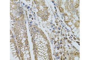Immunohistochemistry of paraffin-embedded Human stomach using SELP Polyclonal Antibody at dilution of 1:100 (40x lens). (P-Selectin 抗体)