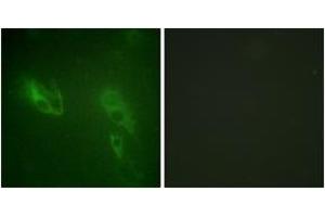 Immunofluorescence analysis of NIH-3T3 cells, using IR (Ab-999) Antibody. (IR (AA 881-930) 抗体)