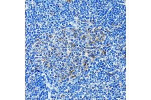 Immunohistochemistry of paraffin-embedded rat spleen using PAICS antibody. (PAICS 抗体)