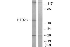 Western blot analysis of extracts from Jurkat cells, using HTR2C antibody. (HTR2C 抗体  (C-Term))
