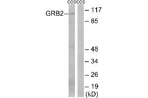 Immunohistochemistry analysis of paraffin-embedded human colon carcinoma tissue using GRB2 (Ab-159) antibody. (GAB2 抗体  (Ser159))