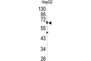 Western Blotting (WB) image for anti-Arylsulfatase B (ARSB) antibody (ABIN3003229) (Arylsulfatase B 抗体)