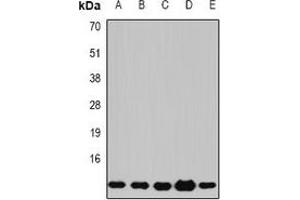 Western blot analysis of Beta 2 Microglobulin expression in Jurkat (A), COS7 (B), K562 (C), mouse lung (D), mouse liver (E) whole cell lysates. (beta-2 Microglobulin 抗体)
