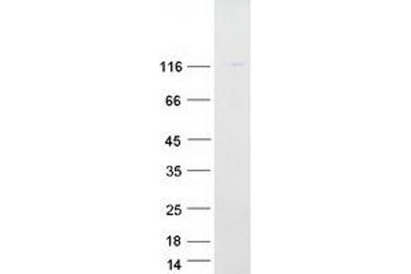 ATP6V0A1 Protein (Transcript Variant 3) (Myc-DYKDDDDK Tag)