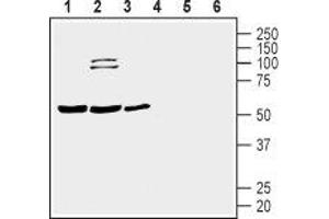 Western blot analysis of human Jurkat T-cell leukemia cell (lanes 1 and 4), human THP-1 monocytic leukemia cell (lanes 2 and 5) and human MEG-01 megakaryoblastic leukemia cell (lanes 3 and 6) lysates: - 1-3. (Prostacyclin Receptor 抗体  (3rd Extracellular Loop))