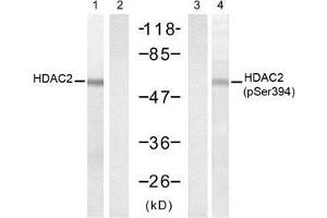 Western blot analysis of extracts from HT-29 cells untreated or treated with UV (20min), using HDAC2 (Ab-394) antibody (E021140, Lane 1 and 2) and HDAC2 (Phospho-Ser394) antibody (E011191, Lane 3 and 4). (HDAC2 抗体  (pSer394))