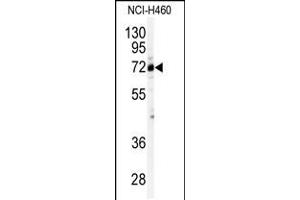 Western blot analysis of anti-CSTF2 Antibody in NCI-H460 cell line lysates (35ug/lane). (CSTF2 抗体  (N-Term))