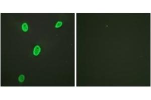 Immunofluorescence analysis of HeLa cells, using Histone H4 (Acetyl-Lys12) Antibody. (Histone H4 抗体  (acLys12))