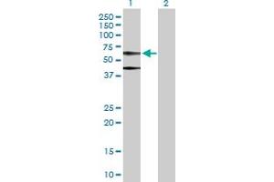 Western Blot analysis of ACTB expression in transfected 293T cell line by ACTB MaxPab polyclonal antibody. (beta Actin 抗体  (AA 1-375))