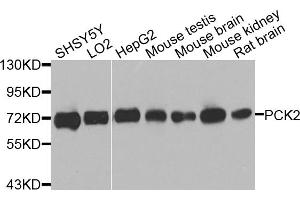 Western blot analysis of extracts of various cell lines, using PCK2 antibody. (PEPCK 抗体)