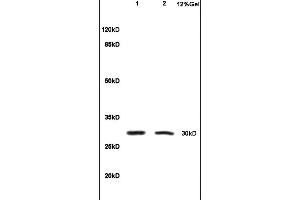 Formalin-fixed and paraffin embedded rat colitis tissue labeled with Anti-IL-1 Beta/IL-1B Polyclonal Antibody, Unconjugated (ABIN872644) at 1:200, followed by conjugation to the secondary antibody and DAB staining (IL-1 beta 抗体  (AA 161-269))