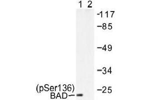Image no. 1 for anti-BCL2-Associated Agonist of Cell Death (BAD) (pSer136), (pSer99) antibody (ABIN317969) (BAD 抗体  (pSer99, pSer136))