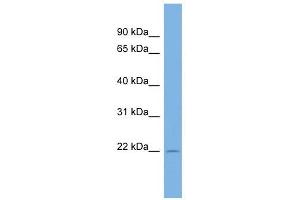 C13ORF28 antibody used at 1 ug/ml to detect target protein. (SPACA7 抗体  (Middle Region))